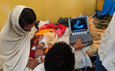 Reducing NTDs with Folic Acid